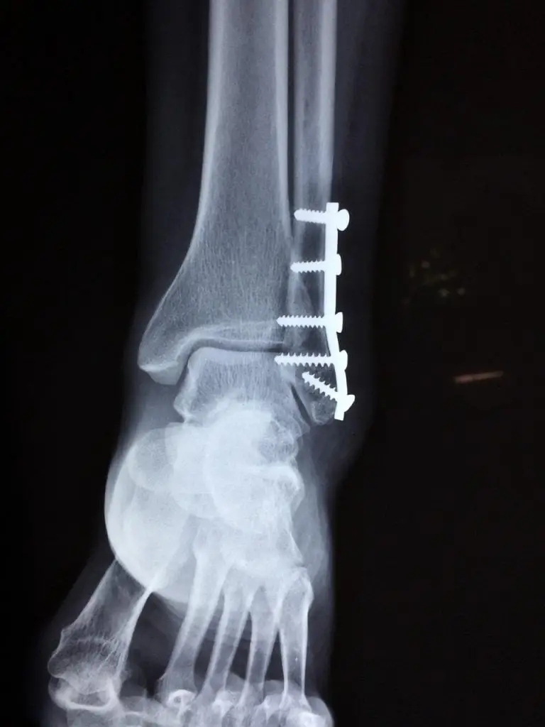 Orthopedie in Groningen