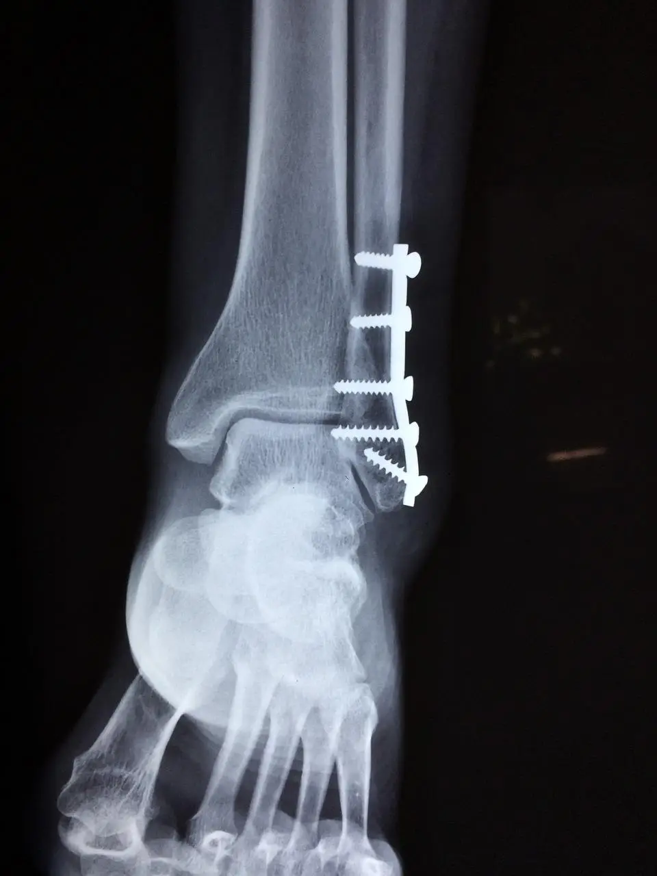 Orthopedie in Groningen