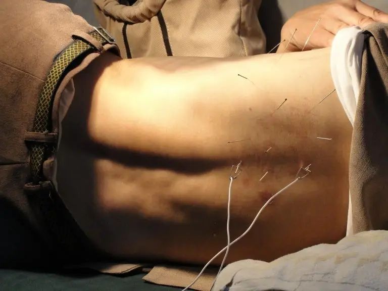 Acupuncturist in Groningen